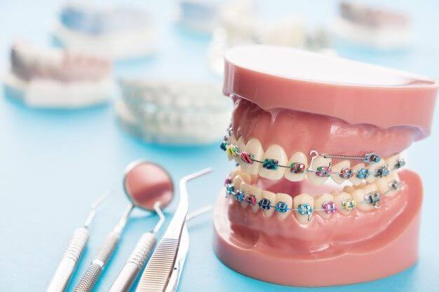 Microimplantes